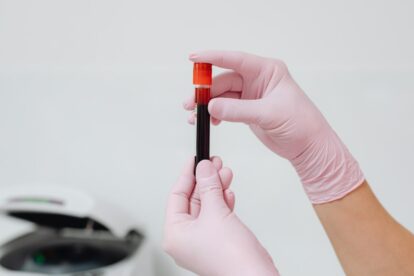 20/20 GeneSystems Makes Cancer Screening Affordable